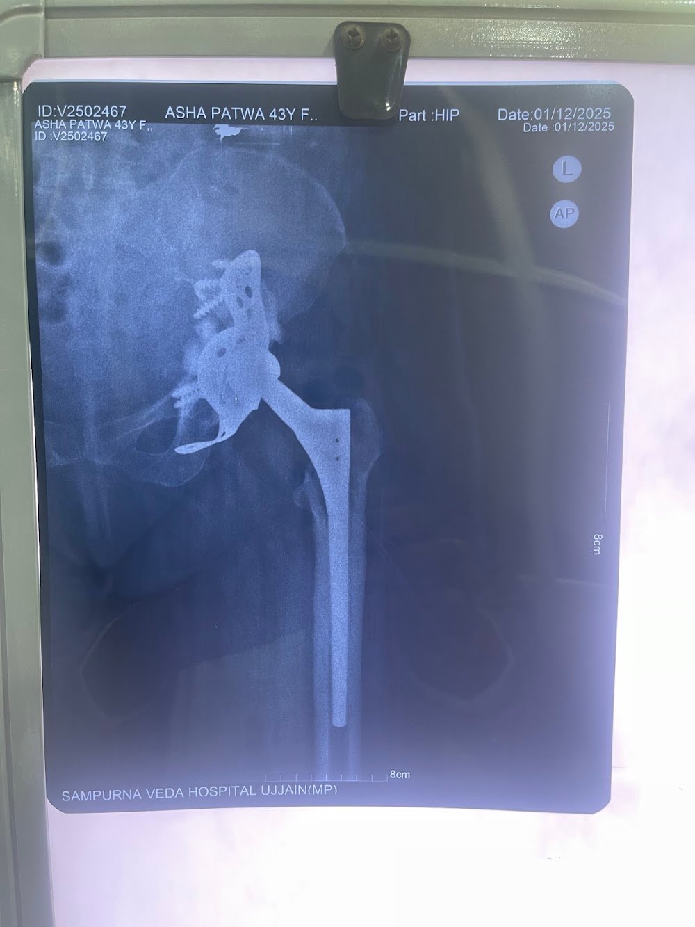 Orthopedic doctor in ujjain, orthopedic surgeon in ujjain,Dr.Ajay Dandotiya orthopedic surgeon ujjain