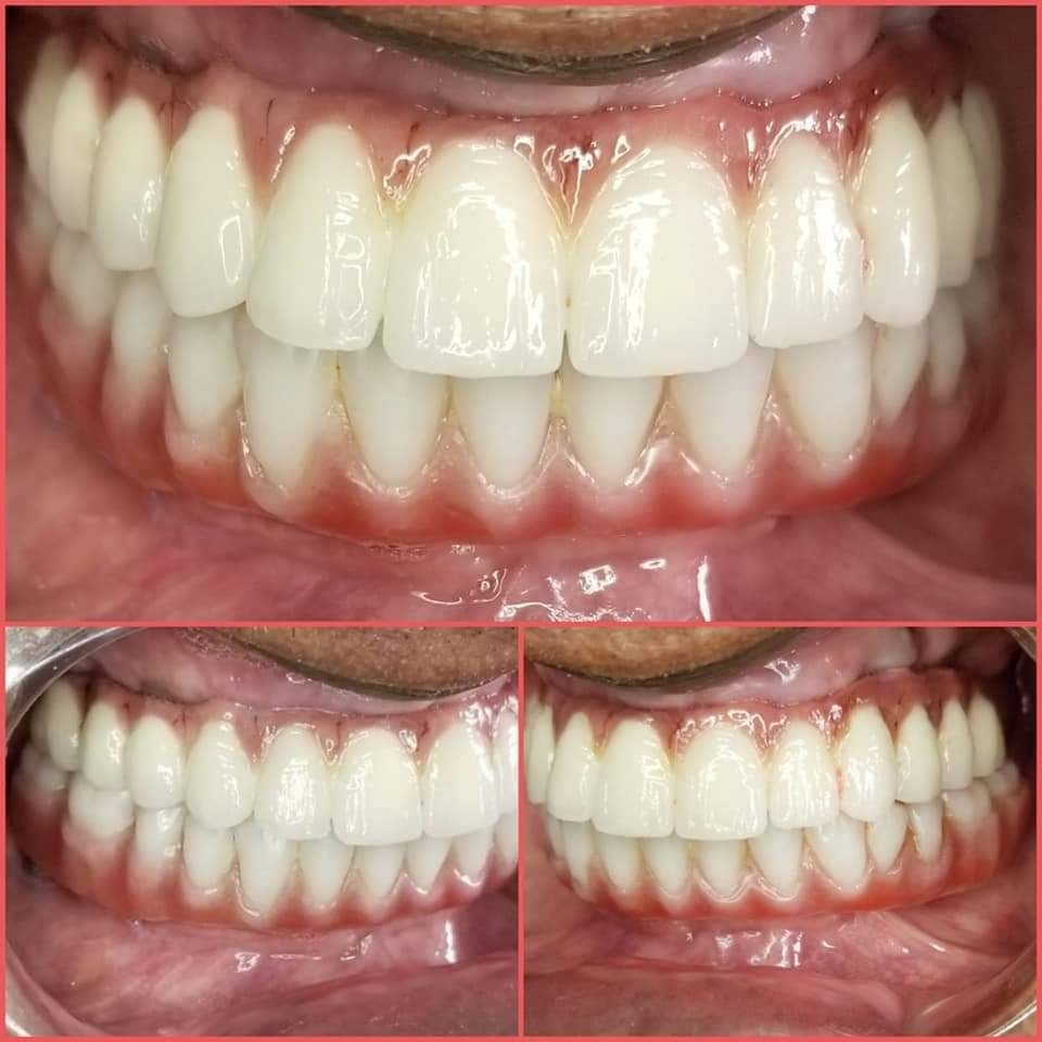 SMILE UJJAIN DENTAL CLINIC