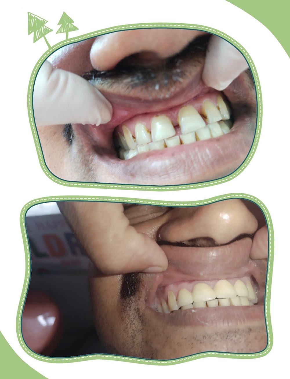 SMILE UJJAIN DENTAL CLINIC